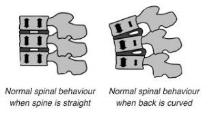 spinal movement and good posture, back strengthening exercises, spinal health and mobility